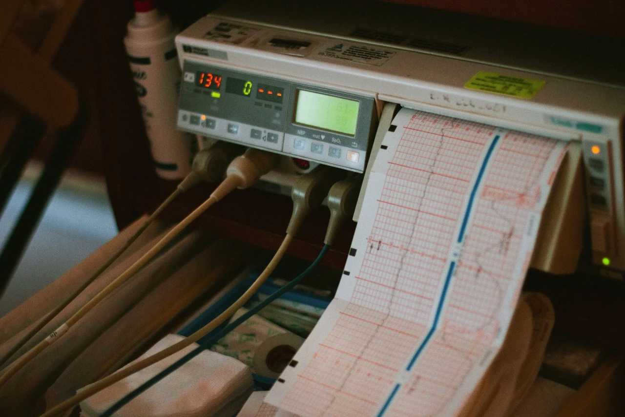 Prueba de esfuerzo cardiopulmonar CPET — paciente en bicicleta ergométrica con mascarilla de análisis de gases y monitor de signos vitales en Medimanage Research CDMX