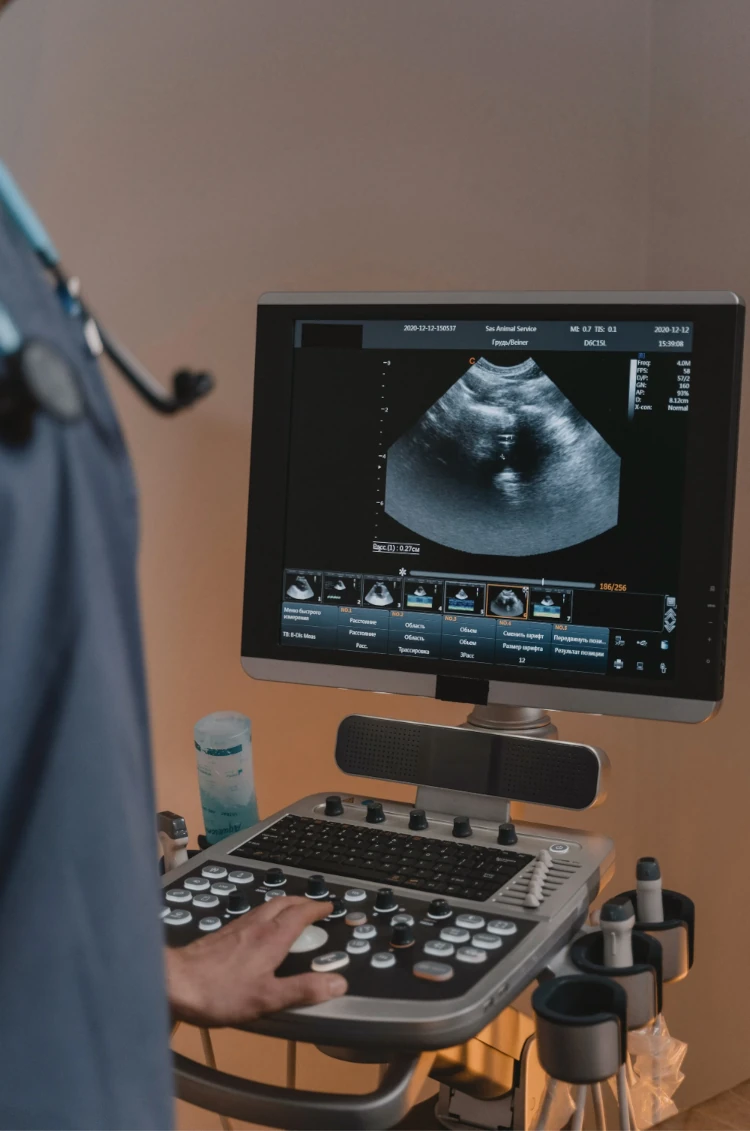 Ecocardiograma farmacológico con dobutamina — especialista monitoreando función cardíaca sin ejercicio en Medimanage Research Tlalpan CDMX